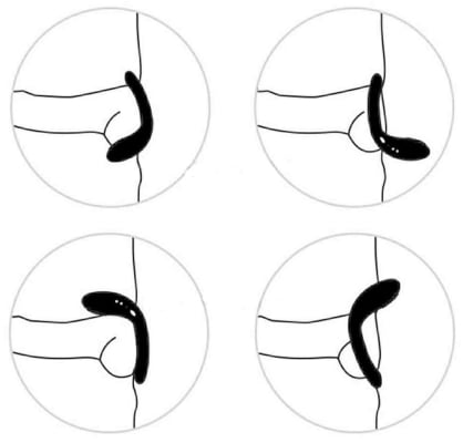 Lovense Diamo Anel Peniano Vibratório Estimulador de Períneo Inteligente e Interativo com Vibrações Programáveis, Controle à Distância por Aplicativo, Bluetooth iOS e Android, em Silicone Flexível
